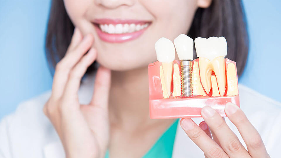 Dental Implants in Kusadasi - Dentists for Implants